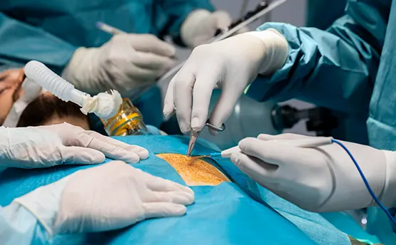 Surgical Gastroenterology